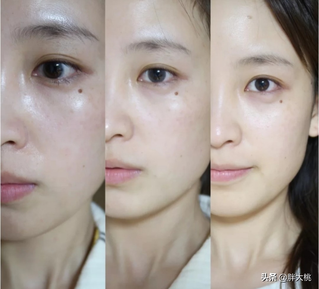 烟酰胺是真的能让人变白吗,烟酰胺成分能让皮肤白吗