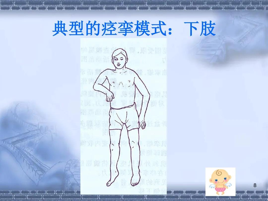 偏瘫患者手脚分离的锻炼方法,脑出血左手偏瘫如何自己锻炼