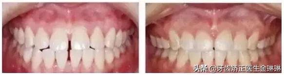 淄博诺尔曼齿科种牙怎么样,淄博诺尔曼齿科整牙费用