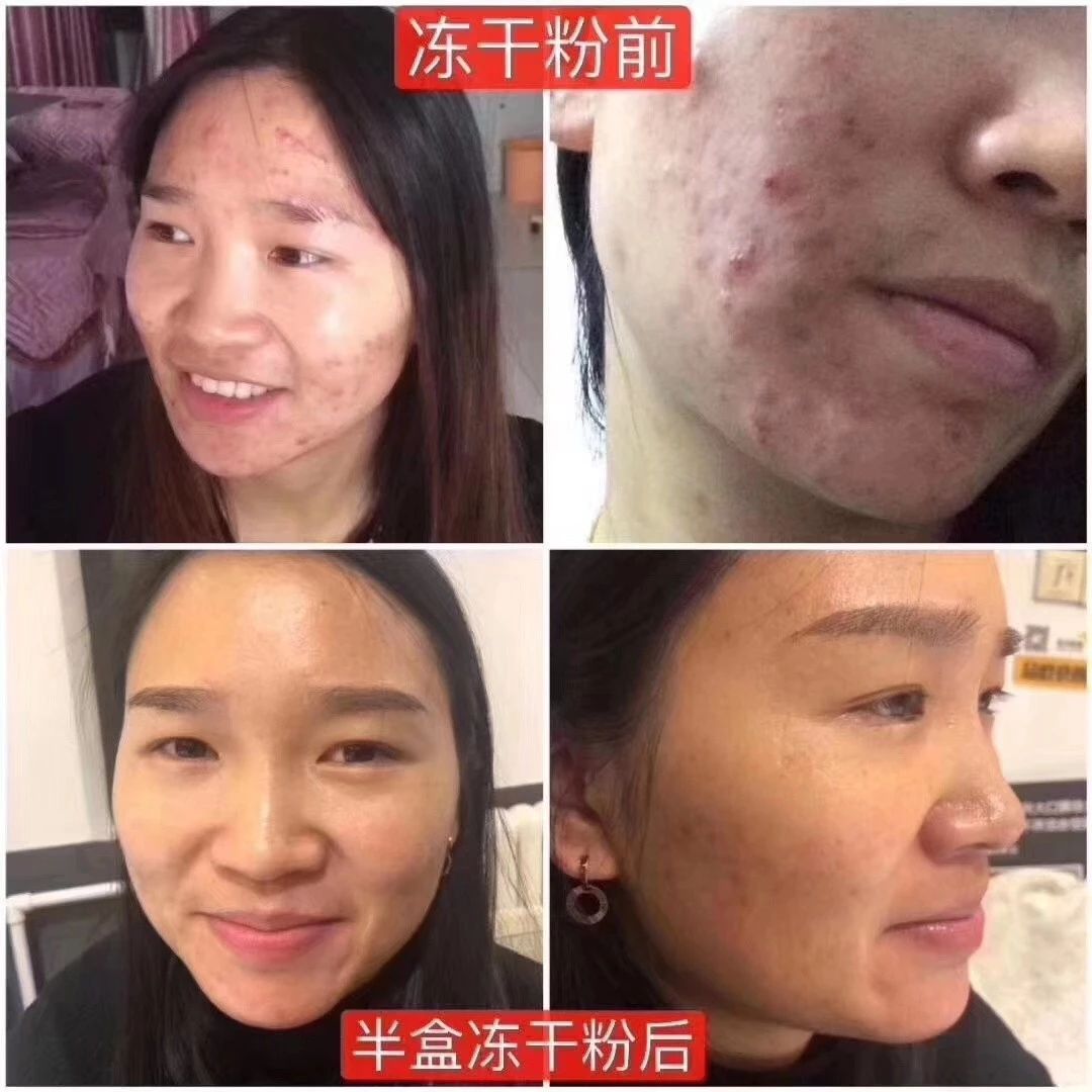 口罩大了戴口罩的小技巧,口罩继续戴防护不松懈