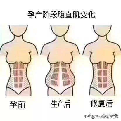 女生怎么练改善斜方肌,斜方肌练大了