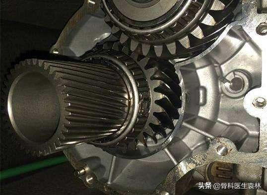 膝关节退行性病变怎么治_膝关节退行性病变该如何治疗