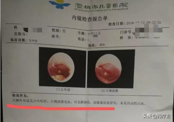 情侣接吻时哪些地方是禁区,情侣之间除了接吻还有什么暧昧