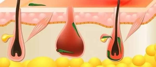 犬常见皮肤病,犬常见皮肤病症状有哪些