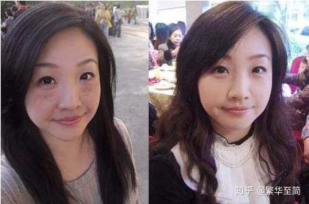 什么药膏能消除脸上的色斑,过敏后脸上的色斑怎么快速消除