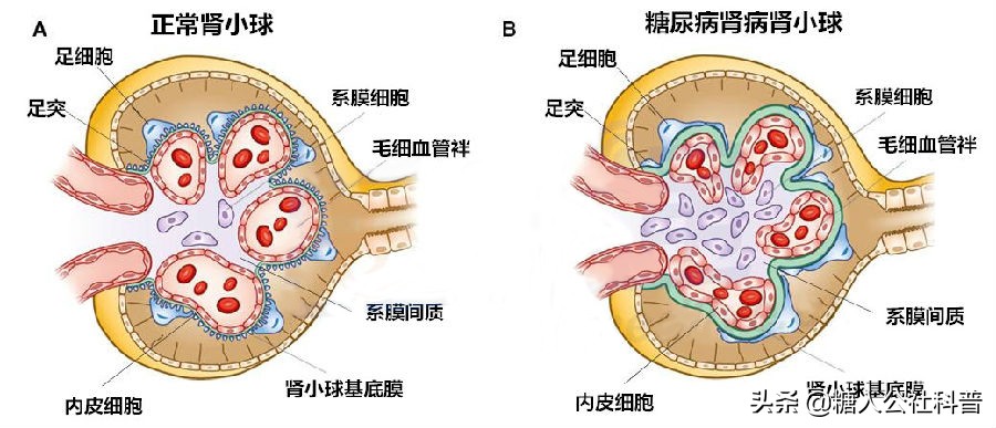 糖尿病夫妻相处的后果,糖尿病夫妻怎么治疗
