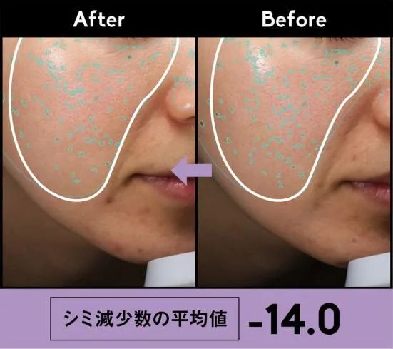 贵妇美白精华测评,不花冤枉钱国货推荐