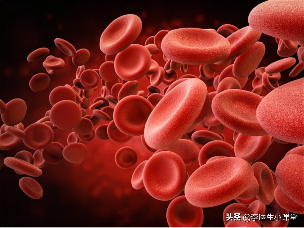 胆红素稍高一点要紧吗,胆红素稍高吃什么药