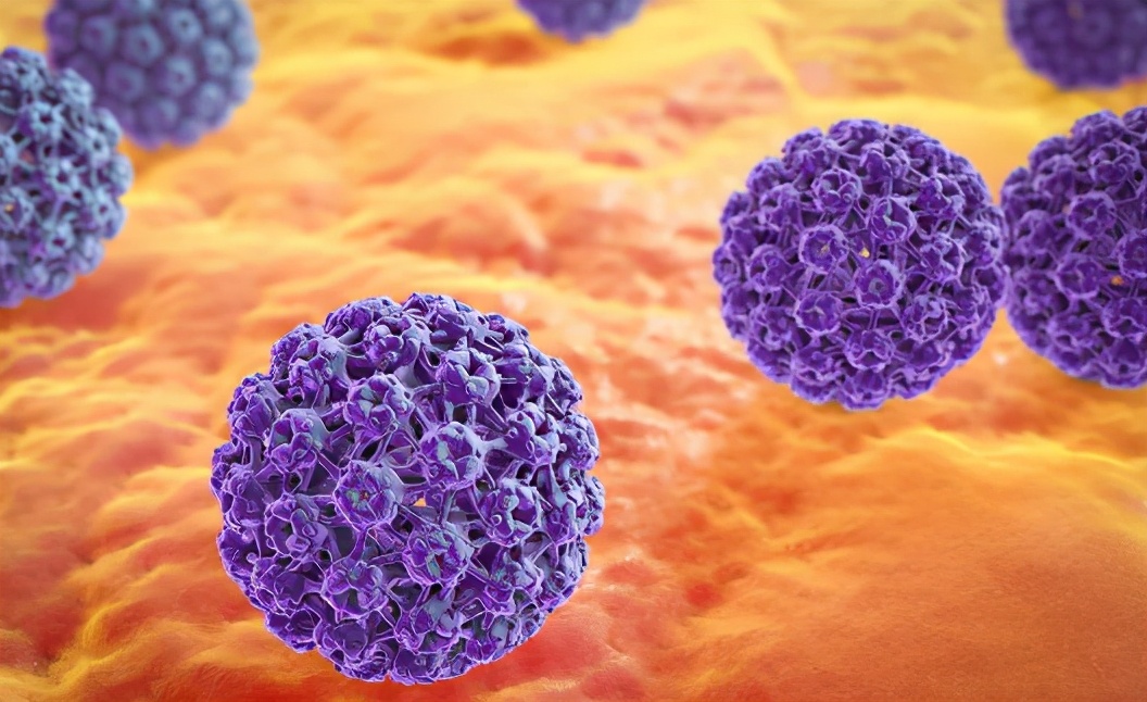 女朋友检测出hpv但我一年没有症状,90后夫妻双双感染hpv