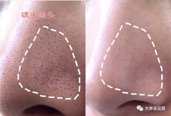 大牌洗面奶哪款好用排行榜最新版,洗面奶到底哪款好用又实惠