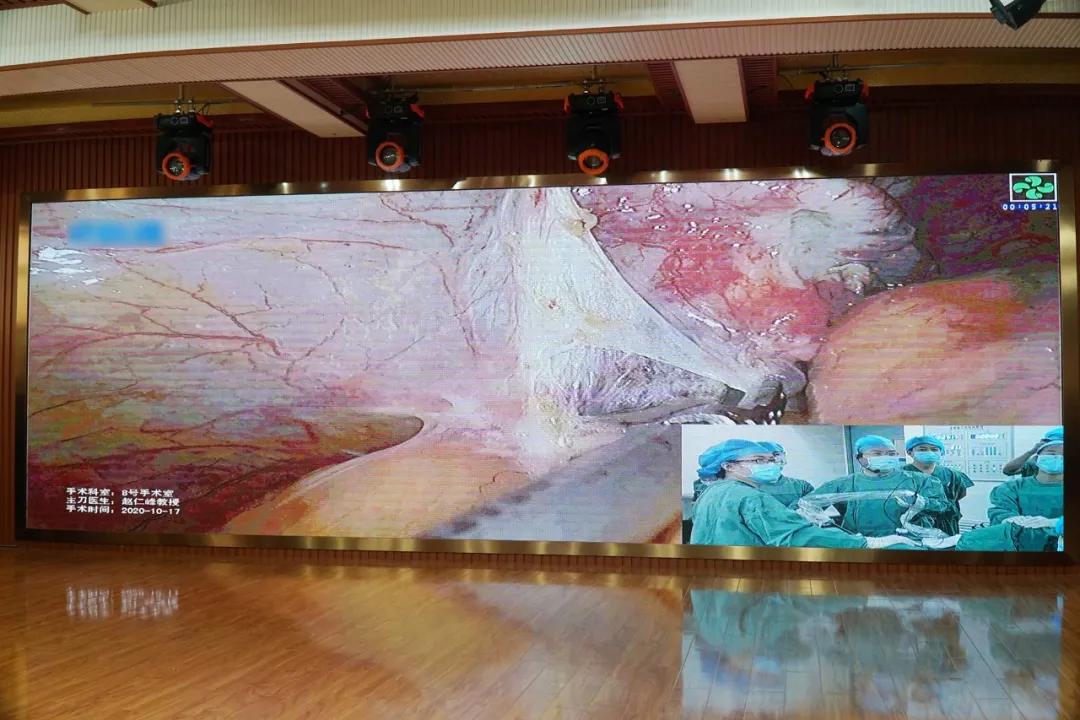 桂林市妇幼保健院成功举办桂林市宫颈癌筛查适宜技术暨妇科肿瘤及内镜规范化诊疗培训班