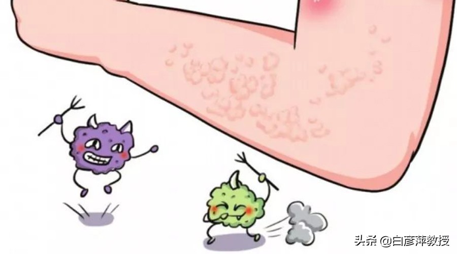 麻疹怎么处理好得快,麻疹荨麻疹怎么治才能好