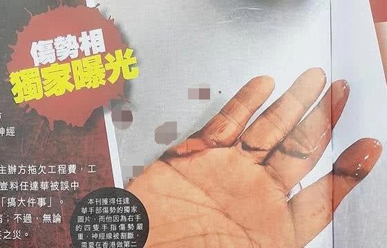 任达华被刺后露面,任达华被刺伤情