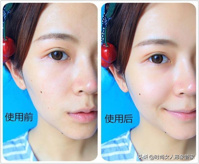 脸上的黑头让人讨厌，严重拉低你的颜值，如何有效祛黑头？