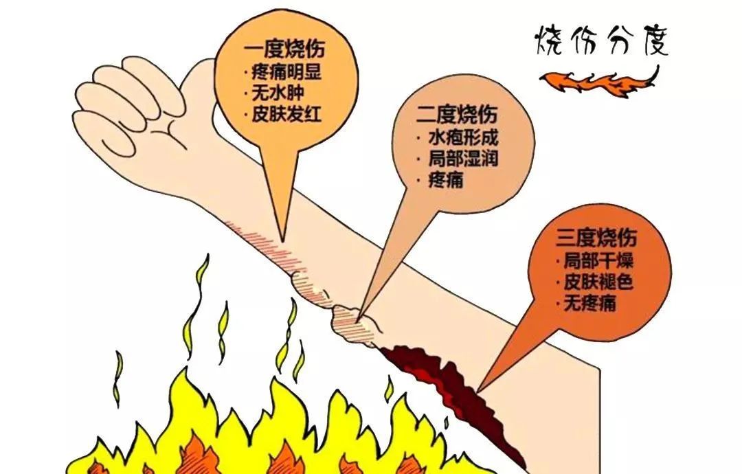 烫伤后及时清创能促进伤口愈合吗,深度烫伤后多久植皮比较好