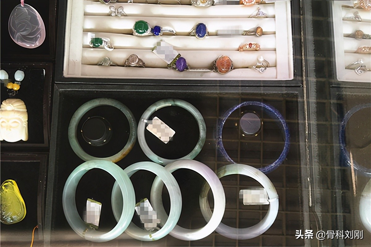 玉手镯戴几个月变黑了,玉手镯戴久了有血筋