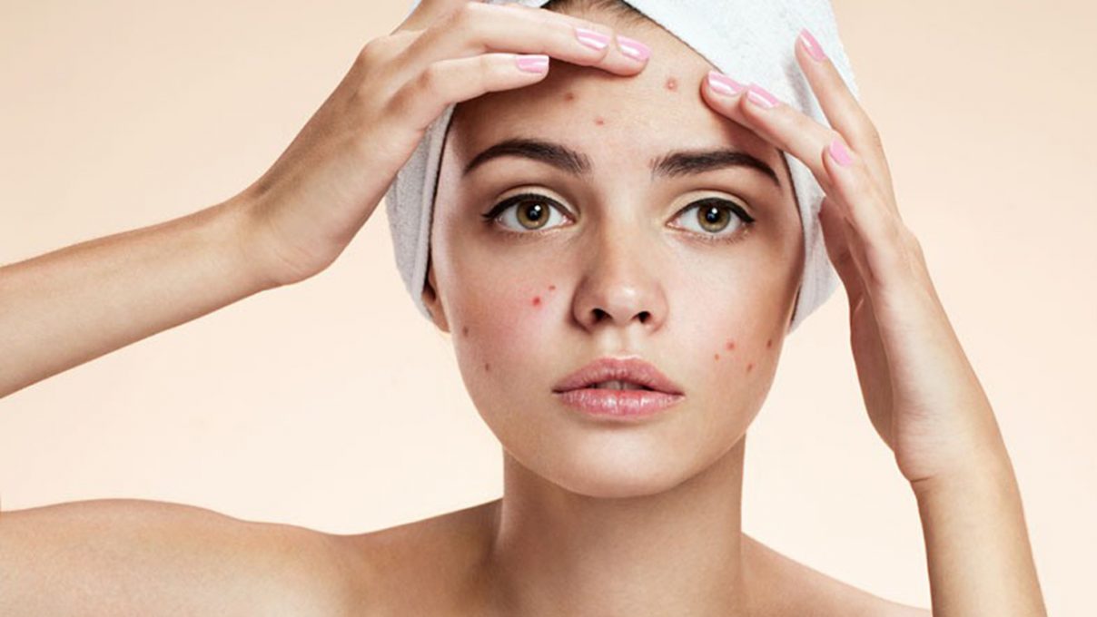 毛孔粗大有治好的吗,毛孔粗大如何改善最简单的办法