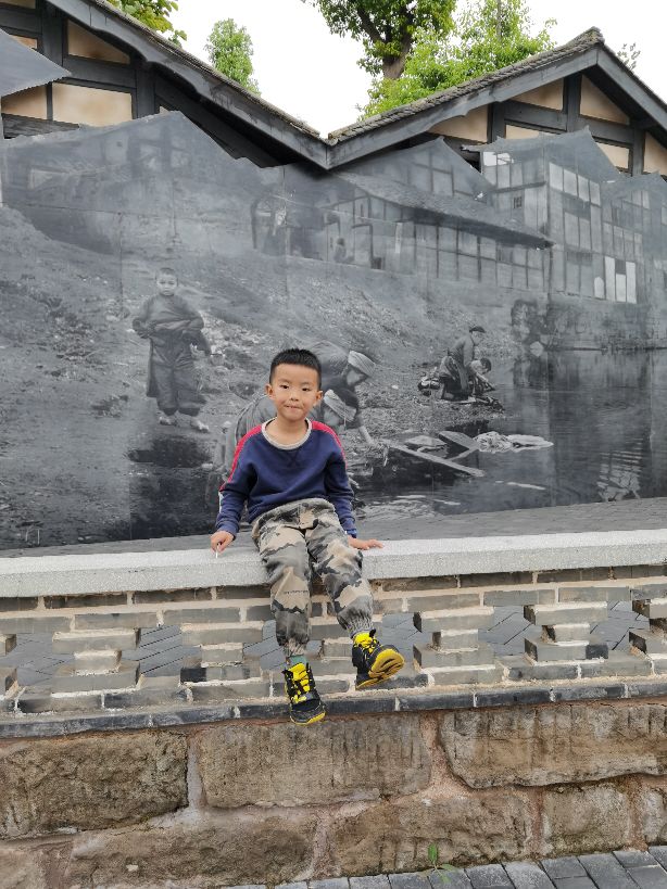 小耳畸形再造手术有后遗症吗,儿童小耳畸形去哪里做手术好