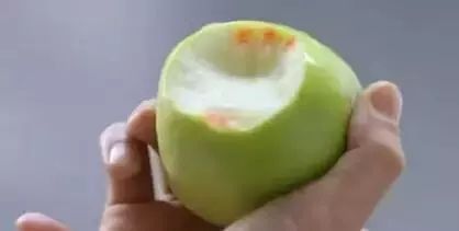 这4种病不能完全治愈,可以治愈的五种癌症不必过度恐慌