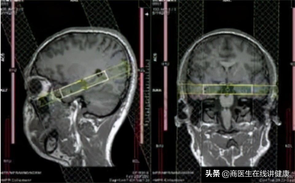 佩梅病临床治疗,佩梅病病情发展