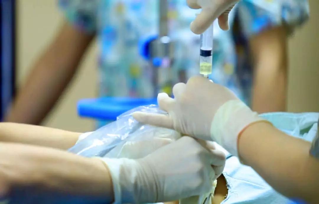 羊穿胎儿异常几率,羊穿没问题但是胎儿畸形