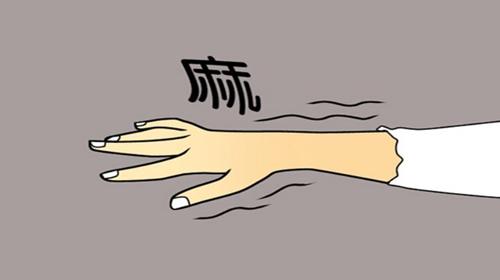 夜间手指麻木警惕腕管综合征,腕管综合征手麻一招解决