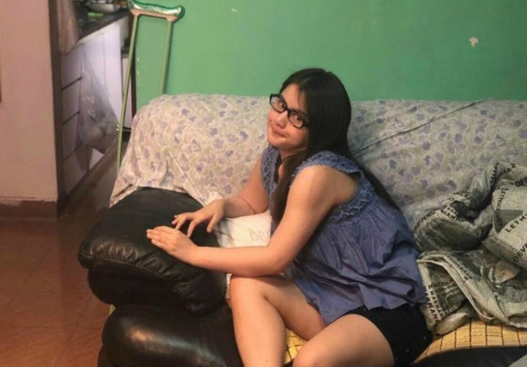 宅男女神邓月平戒口吃“草”曾荷尔蒙失调惹湿疹满身抓痕