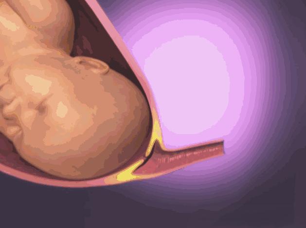 顺产开十指是十根手指宽吗,顺产开十指要侧切吗