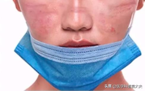 戴口罩时间长了耳朵疼怎么解决,戴口罩防止眼镜起雾最佳方法