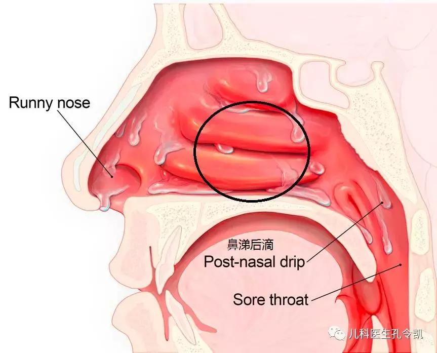 孩子感冒咳嗽过后怎么调理饮食,感冒引起咳嗽和上呼吸道感染咳嗽