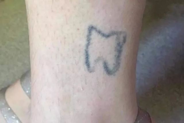 纹身后悔了怎么才能消除,半永久的纹身能去除干净吗