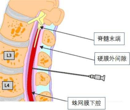 脑脊液检查结果都没事,脑脊液常规数值100