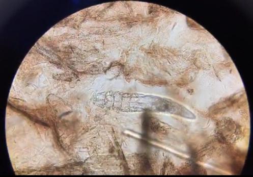 犬常见皮肤病,犬常见皮肤病症状有哪些