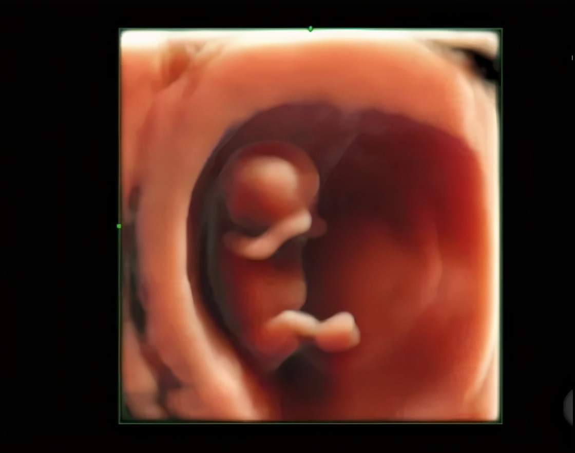 孕期检查做几次四维彩超,孕期产检需要做几次肝胆彩超