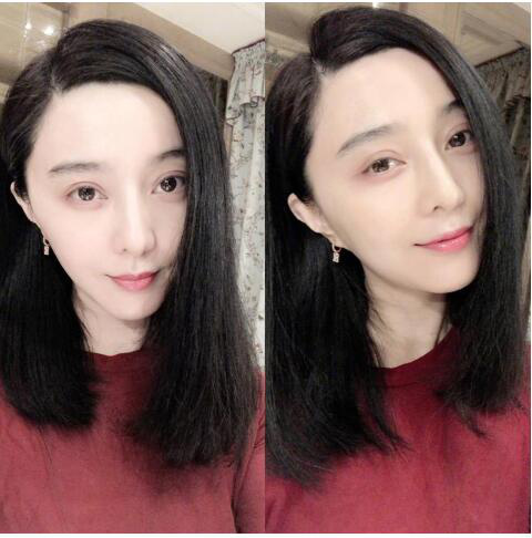 发质偏软m型秃头适合的发型,女生头顶很秃头适合什么发型