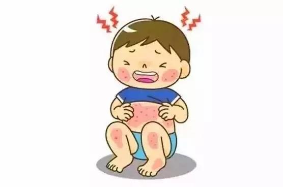 炉甘石洗剂有哪些用途?听听药师怎么说