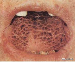 最实用的舌诊图六大舌象,舌诊深入学习书