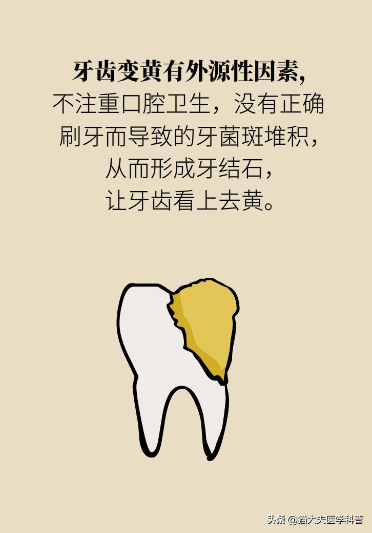 牙齿美白去黄的最快方法,牙黄怎么变白最快最有效方法