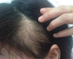 赋强保湿洗发水,赋强fortro防脱洗发水真实测评