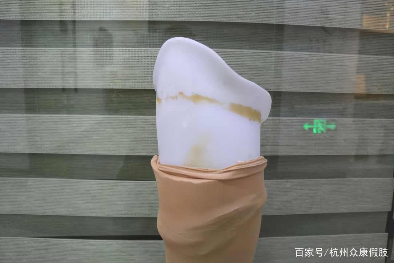 假肢接收腔选用材料详解,云南仿生假肢接收腔