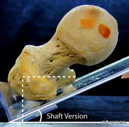 髋膝关节文献精译荟萃