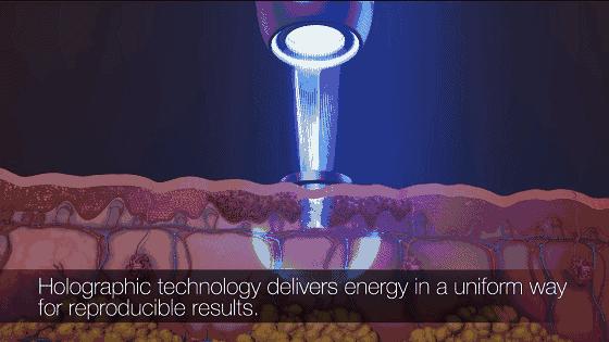 激光美容有哪些项目,激光美容都有哪些项目