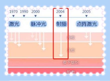 还不到30岁的郑爽，法令纹就这么明显了？*力暴**按摩，她的脸没事吧