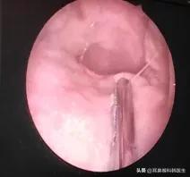 为啥来院就做内镜检查?医生怕是在骗我钱吧