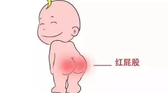 健康宝宝要知道（二十三）如何护理新生儿的小屁屁