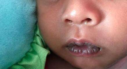 世界上最好看的嘴唇形状,世界最厚嘴唇的人嘴唇往外翻