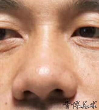 素描入门零基础教程人像鼻子,素描人物头像鼻子详细教程