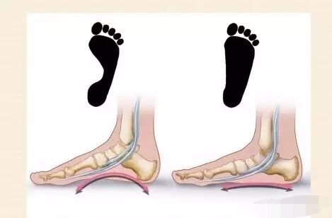 根基建立必练的16体式讲解,根基不稳