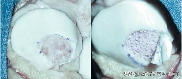 膝盖磕到了没肿但痛,膝盖磕了一下髌腱损伤怎么治