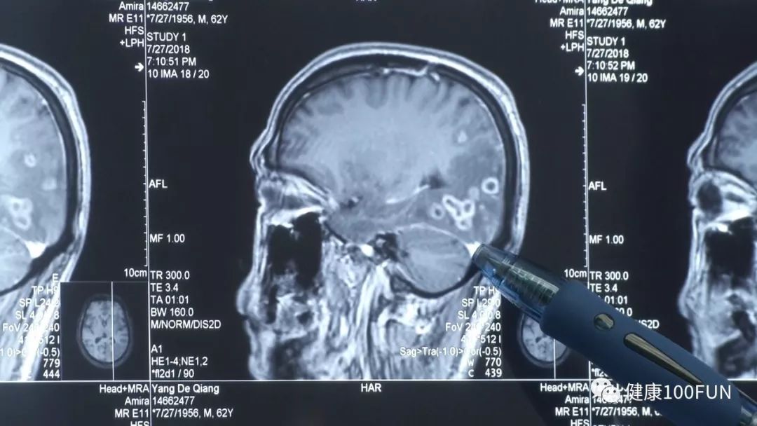 夏天吃海鲜好不好,夏天吃海鲜会怎样